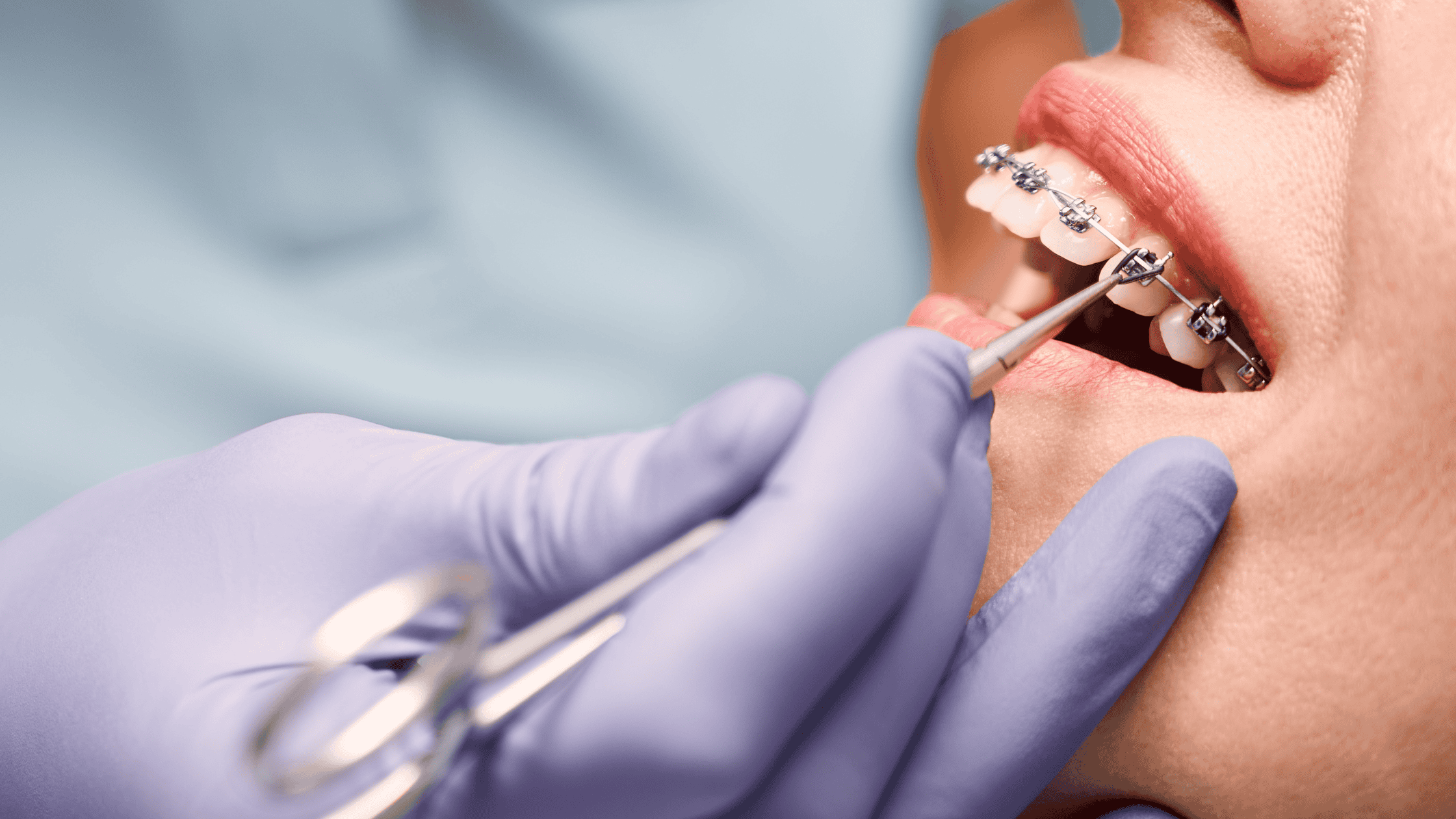 Local Midlothian Orthodontist