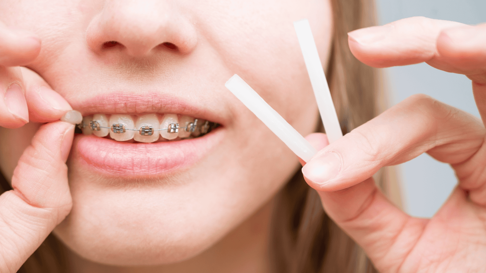 Orthodondist for teens