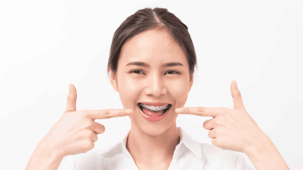 Braces In Midlothian VA