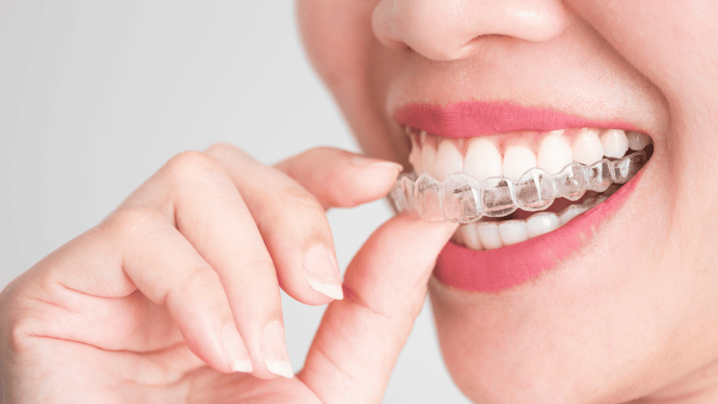 Invisalign With Crowns