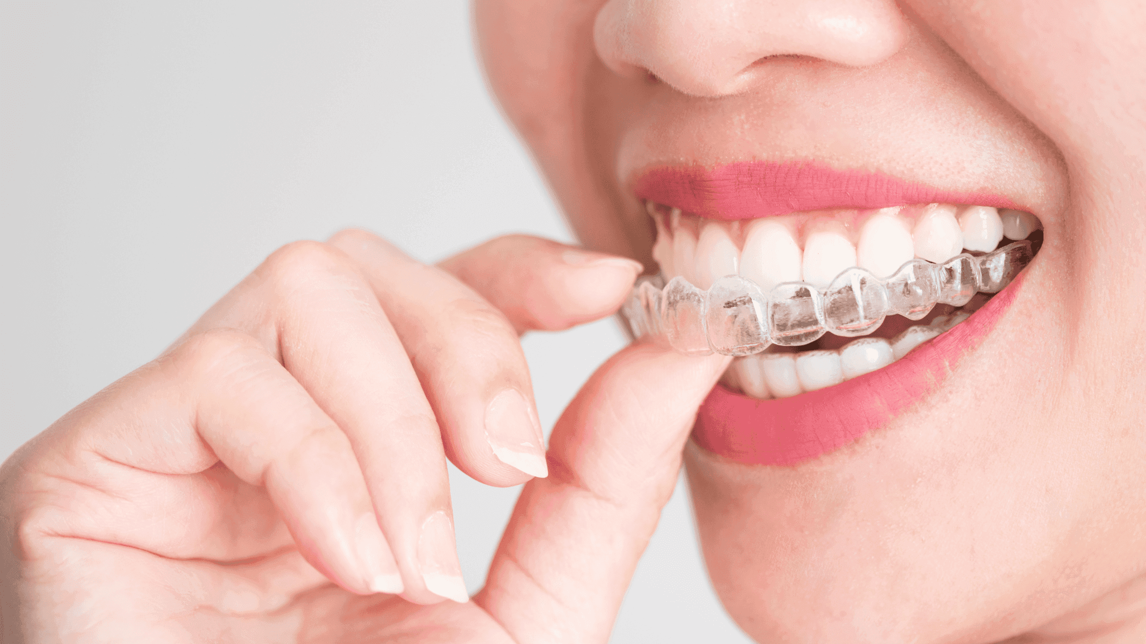 Woman wearing Invisalign 