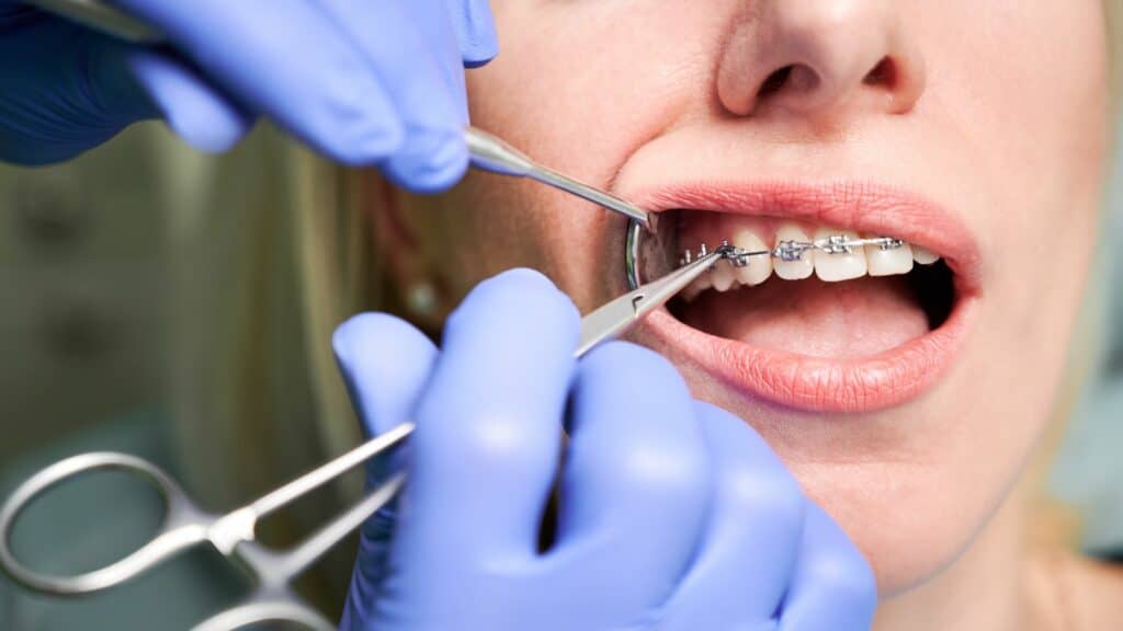 Midlothian Orthodontist