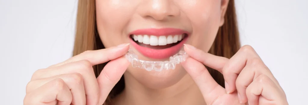Invisalign in Midlothian, VA 1 Woman placing an Invisalign clear aligner, available at our Midlothian, VA office